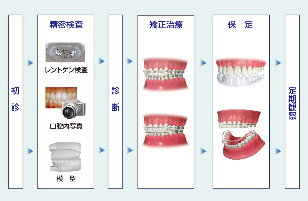 矯正治療の流れ