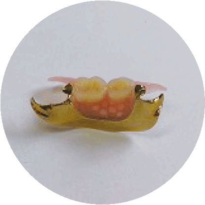 自費治療の部分入れ歯2