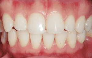 歯列矯正・ホワイトニング 自費治療